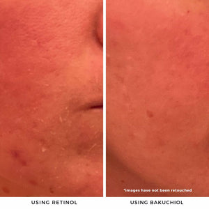 Vacay Vibes Bakuchiol Kit Cosmetic Sets Caley