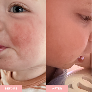 best baby lotion for barrier support