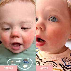 best baby balm for sensitive skin