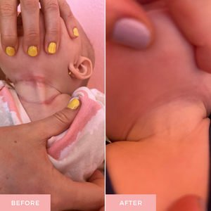 A split-screen comparison labeled BEFORE and AFTER showing a close-up of a baby's neck and upper chest with a pink and white swaddle. A hand with yellow nail polish is visible in the before panel, and the after panel shows the swaddle alone against skin.